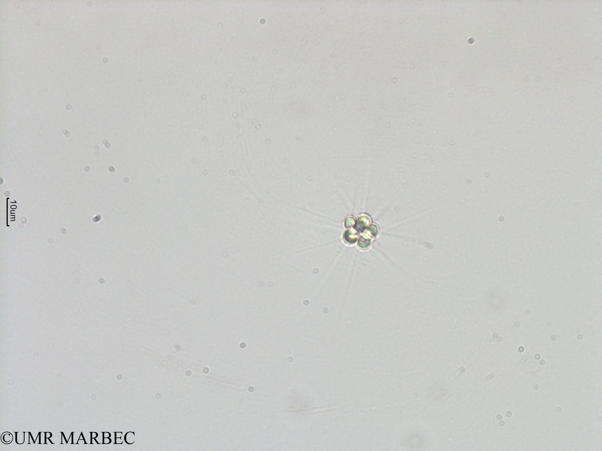phyto/Mayotte/dziani/DZIANI 2007-2016/Micractinium sp2 (Effluent2012_Micractinium sp -5).tif(copy).jpg